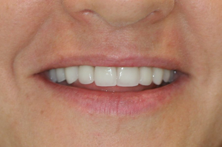 dental patient after 10