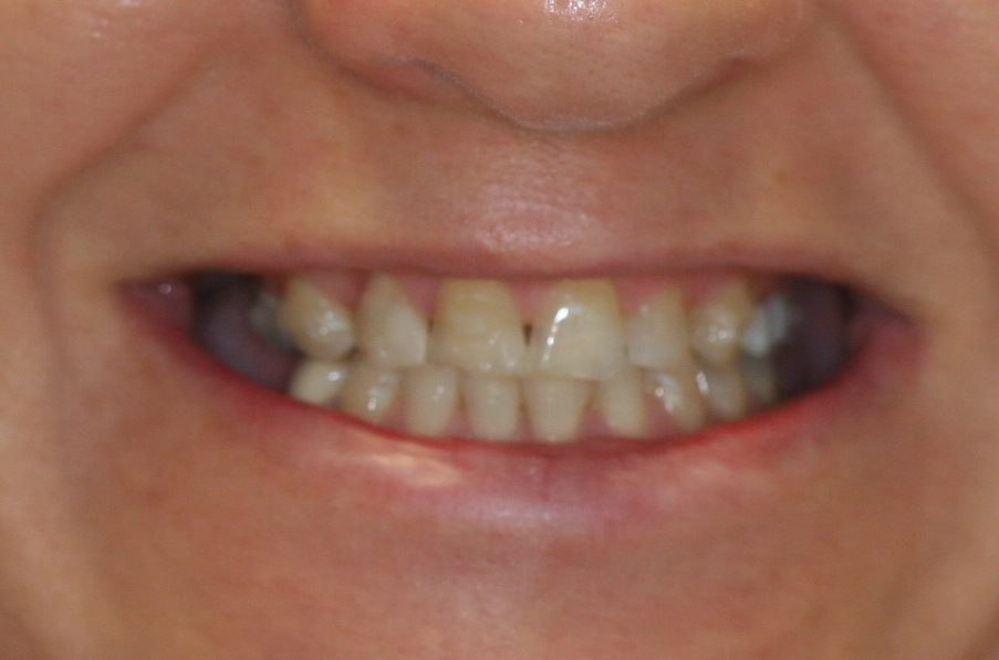 dental patient before 10