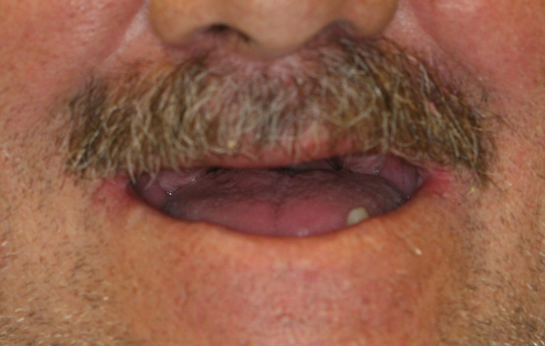 dental patient before 12