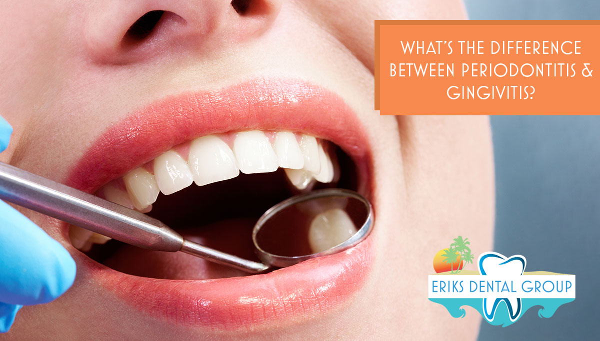 Gingivitis, Periodontitis, And Other Gum Issues