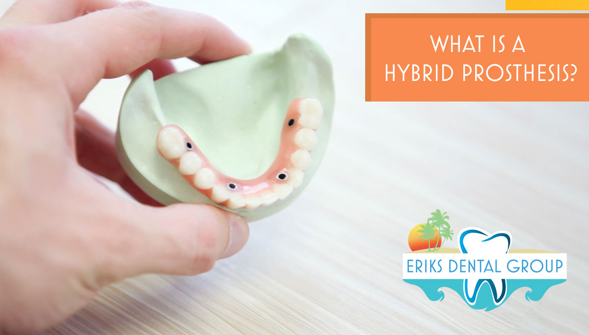 What Is A Hybrid Prosthesis? Eriks Dental Group