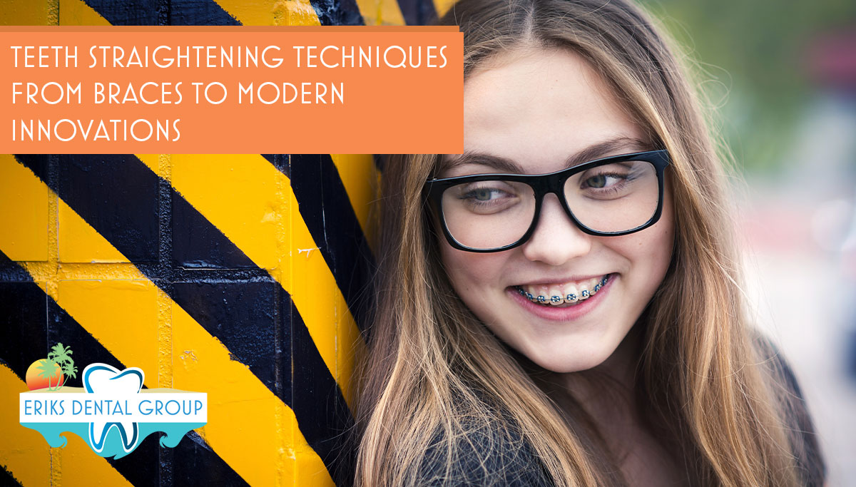 Curated visual reference: Visual Reference: What Teeth Straightening Options Are Available In Boynton Beach