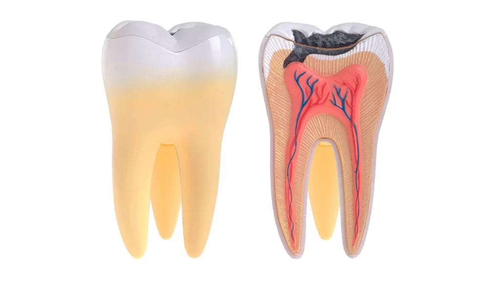 Endodontic Issues