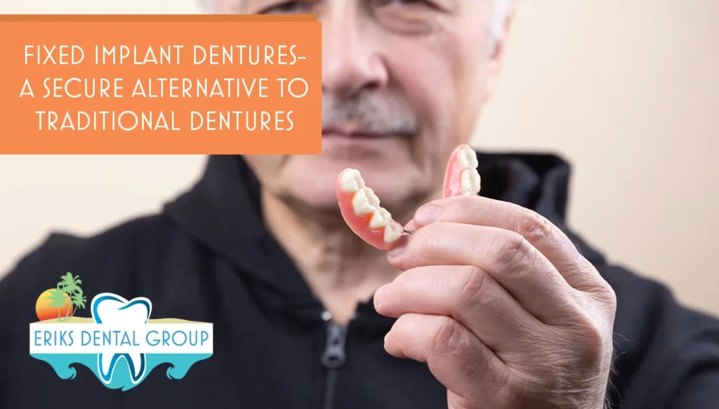 Fixed Implant Dentures