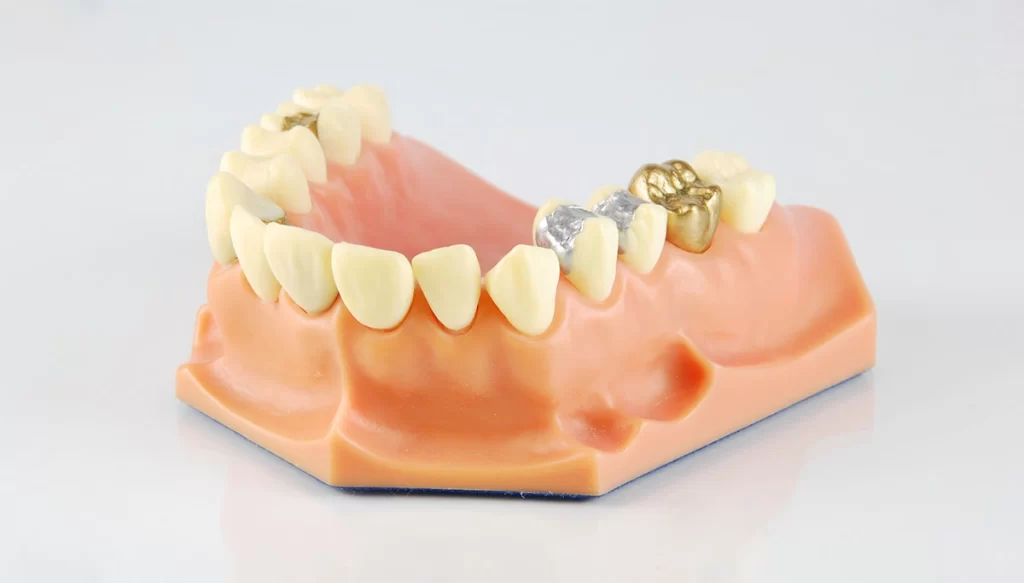 dental crowns