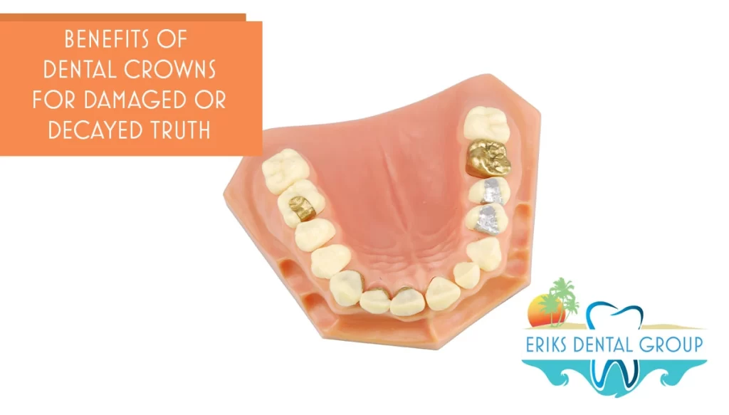 model of a dental crown