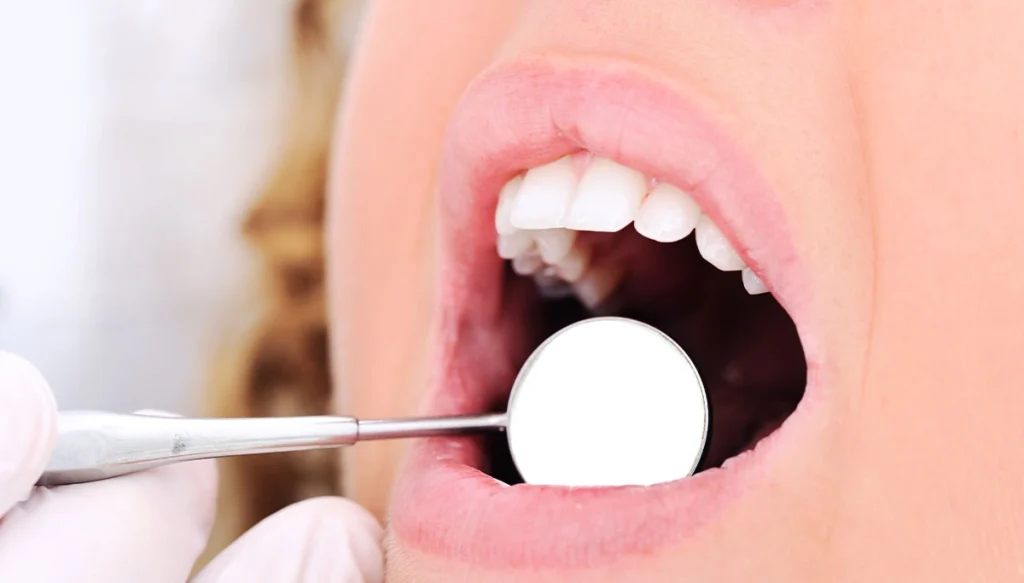 woman with a dental tool in her mouth